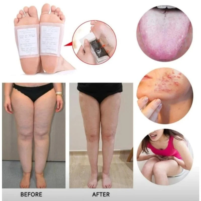 PureStep™ Detox Foot Pads — Gold & White Cleansi...


