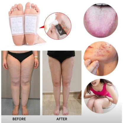 PureStep™ Detox Foot Pads — Gold & White Cleansi...


